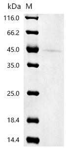 (Tris-Glycine gel) Discontinuous SDS-PAGE (reduced) with 5% enrichment gel and 15% separation gel.