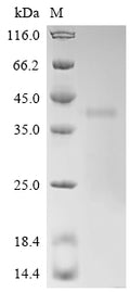 (Tris-Glycine gel) Discontinuous SDS-PAGE (reduced) with 5% enrichment gel and 15% separation gel.