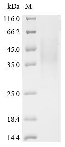 (Tris-Glycine gel) Discontinuous SDS-PAGE (reduced) with 5% enrichment gel and 15% separation gel.