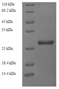 Recombinant Rat Ribosyldihydronicotinamide dehydrogenase (Nqo2) – Figure 1 of 1