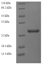 Recombinant Rat Ribosyldihydronicotinamide dehydrogenase (Nqo2) – Figure 1 of 1