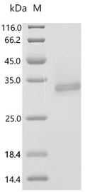 (Tris-Glycine gel) Discontinuous SDS-PAGE (reduced) with 5% enrichment gel and 15% separation gel.