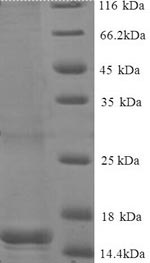Recombinant Human BEN domain-containing protein 3 (BEND3), partial – Figure 1 of 1
