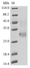 (Tris-Glycine gel) Discontinuous SDS-PAGE (reduced) with 5% enrichment gel and 15% separation gel.