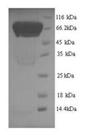 Recombinant Human Autophagy-related protein 16-1 (ATG16L1) – Figure 1 of 1