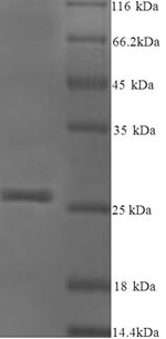 (Tris-Glycine gel) Discontinuous SDS-PAGE (reduced) with 5% enrichment gel and 15% separation gel.