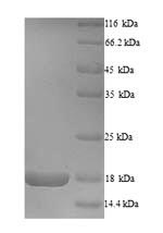 Recombinant Sudan ebolavirus Envelope glycoprotein (GP), partial – Figure 1 of 1