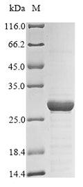 (Tris-Glycine gel) Discontinuous SDS-PAGE (reduced) with 5% enrichment gel and 15% separation gel.