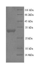 Recombinant Human Protein delta homolog 2 (DLK2), partial – Figure 1 of 1