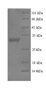 Recombinant Human Protein delta homolog 2 (DLK2), partial – Figure 1 of 1