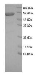 Recombinant Human GRB10-interacting GYF protein 2 (GIGYF2), partial – Figure 1 of 1