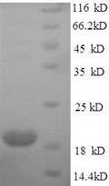 Recombinant Human Immunoglobulin-like domain-containing receptor 2 (ILDR2), partial – Figure 1 of 1