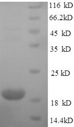 Recombinant Human Immunoglobulin-like domain-containing receptor 2 (ILDR2), partial – Figure 1 of 1