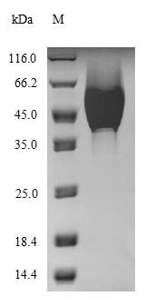 (Tris-Glycine gel) Discontinuous SDS-PAGE (reduced) with 5% enrichment gel and 15% separation gel.