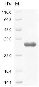 (Tris-Glycine gel) Discontinuous SDS-PAGE (reduced) with 5% enrichment gel and 15% separation gel.