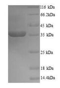 Recombinant Zaire ebolavirus Transcriptional activator VP30 (VP30) – Figure 1 of 1