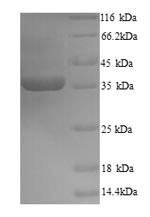 Recombinant Zaire ebolavirus Transcriptional activator VP30 (VP30) – Figure 1 of 1