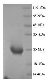 Recombinant Human Butyrophilin subfamily 2 member A1 (BTN2A1), partial – Figure 1 of 1