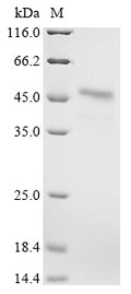 (Tris-Glycine gel) Discontinuous SDS-PAGE (reduced) with 5% enrichment gel and 15% separation gel.