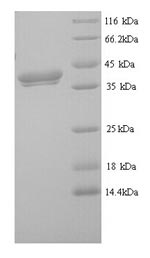 Recombinant Mouse Erythroferrone (Erfe) – Figure 1 of 1
