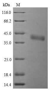 (Tris-Glycine gel) Discontinuous SDS-PAGE (reduced) with 5% enrichment gel and 15% separation gel.