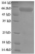 Recombinant Mouse Uncharacterized aarF domain-containing protein kinase 2 (Adck2), partial – Figure 1 of 1