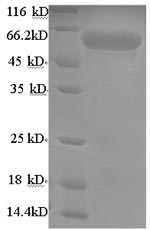 Recombinant Mouse Uncharacterized aarF domain-containing protein kinase 2 (Adck2), partial – Figure 1 of 1