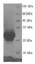 Recombinant Human Cementoblastoma-derived protein 1 (CEMP1) – Figure 1 of 1