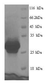Recombinant Human Cementoblastoma-derived protein 1 (CEMP1) – Figure 1 of 1