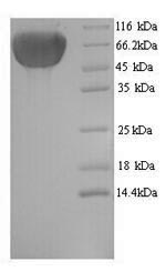 Recombinant Human KeRatin, type II cytoskeletal 1b (KRT77) – Figure 1 of 1
