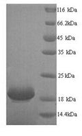 Recombinant Human Ly6/PLAUR domain-containing protein 6 (LYPD6) – Figure 1 of 1