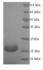 Recombinant Human Ly6/PLAUR domain-containing protein 6 (LYPD6) – Figure 1 of 1