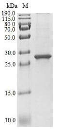 (Tris-Glycine gel) Discontinuous SDS-PAGE (reduced) with 5% enrichment gel and 15% separation gel.