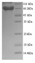 Recombinant Human BRCA1-associated protein (BRAP) – Figure 1 of 1