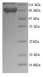 Recombinant Human BRCA1-associated protein (BRAP) – Figure 1 of 1