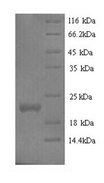 Recombinant Mouse Interferon epsilon (Ifne) – Figure 1 of 1