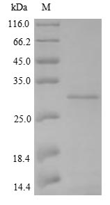 (Tris-Glycine gel) Discontinuous SDS-PAGE (reduced) with 5% enrichment gel and 15% separation gel.