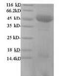 Recombinant Human m7GpppN-mRNA hydrolase (DCP2) – Figure 1 of 1