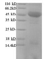 Recombinant Human m7GpppN-mRNA hydrolase (DCP2) – Figure 1 of 1