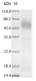 (Tris-Glycine gel) Discontinuous SDS-PAGE (reduced) with 5% enrichment gel and 15% separation gel.