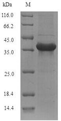 Recombinant Mouse Alpha/beta hydrolase domain-containing protein 11 (Abhd11) – Figure 1 of 1