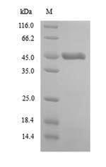 (Tris-Glycine gel) Discontinuous SDS-PAGE (reduced) with 5% enrichment gel and 15% separation gel.