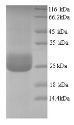 Recombinant Human CMRF35-like molecule 1 (CD300LF), partial – Figure 1 of 1