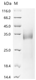(Tris-Glycine gel) Discontinuous SDS-PAGE (reduced) with 5% enrichment gel and 15% separation gel.