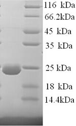 Recombinant Human Dystonin (DST), partial – Figure 1 of 1
