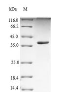 Recombinant Human Poliovirus receptor-related protein 4 (NECTIN4), partial – Figure 1 of 1