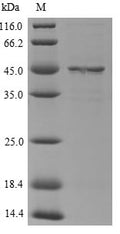 (Tris-Glycine gel) Discontinuous SDS-PAGE (reduced) with 5% enrichment gel and 15% separation gel.