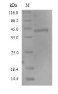 (Tris-Glycine gel) Discontinuous SDS-PAGE (reduced) with 5% enrichment gel and 15% separation gel.