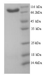 Recombinant Human B-cell scaffold protein with ankyrin repeats (BANK1) – Figure 1 of 1