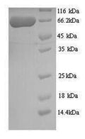 Recombinant Human Twinkle mtDNA helicase (TWNK) – Figure 1 of 1